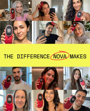 Nova 5-in-1 Scalp Rejuvenation System