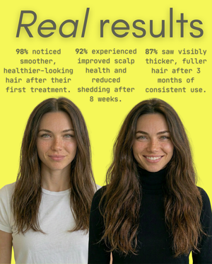 Nova 5-in-1 Scalp Rejuvenation System